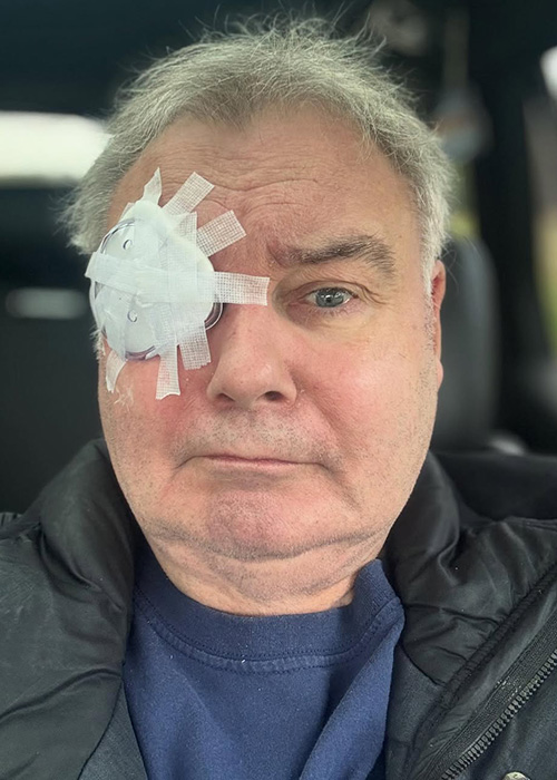 ‘You should see the other guy!’ — Eamonn Holmes sparks concern with latest procedure 4 Eamonn Holmes
